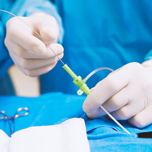 Implantieren eines Portkatheters im Rahmen eines operativen Eingriffes.